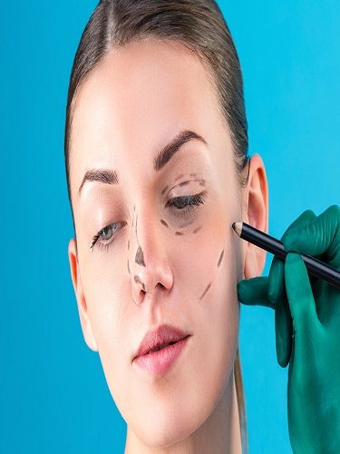 Ameliyatsız Burun Dikleştirme Ameliyatsız Burun Dikleştirme