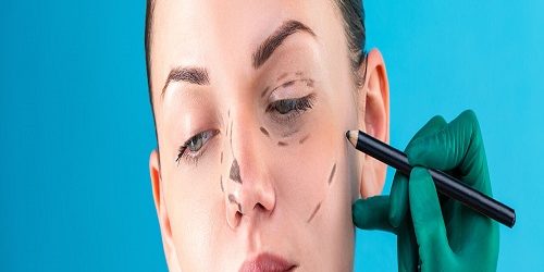 Ameliyatsız Burun Dikleştirme Ameliyatsız Burun Dikleştirme