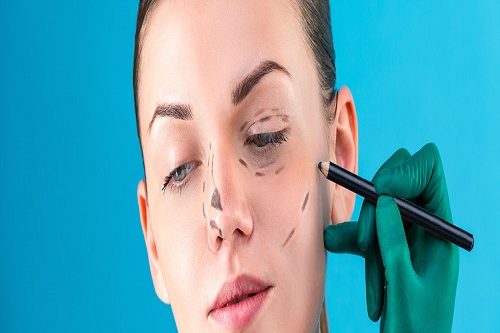 Ameliyatsız Burun Dikleştirme