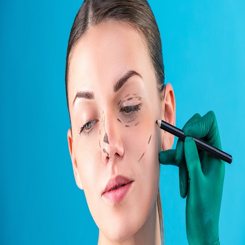 Ameliyatsız Burun Dikleştirme Ameliyatsız Burun Dikleştirme