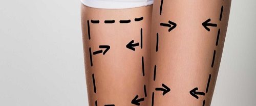 Bacak Germe Ameliyatı