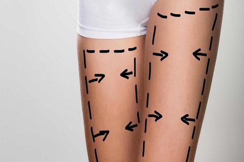 Bacak Germe Ameliyatı