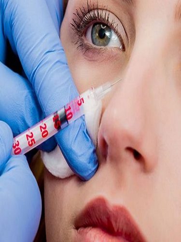 Burun Dolgusu Burun Dolgusu