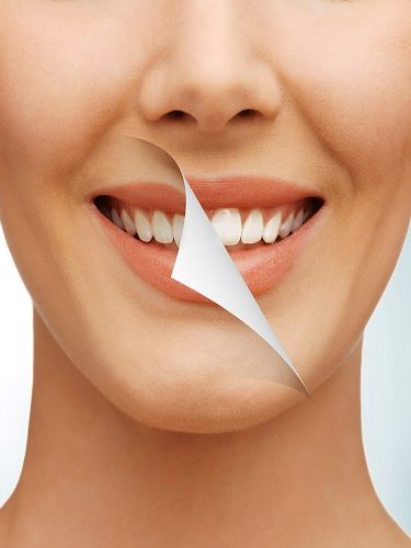 Diş Estetiği Diş Estetiği