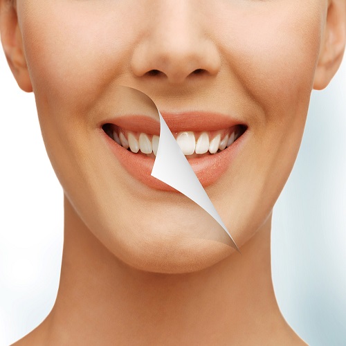 Diş Estetiği Diş Estetiği