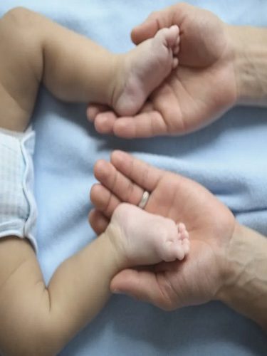 Doğuştan Çarpık Ayak Doğuştan Çarpık Ayak