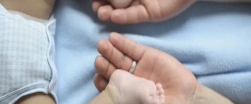 Doğuştan Çarpık Ayak