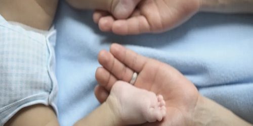 Doğuştan Çarpık Ayak