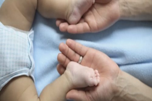 Doğuştan Çarpık Ayak