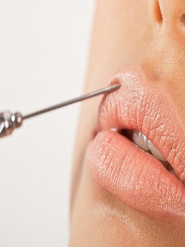 Dudak Dolgusu Dudak Dolgusu