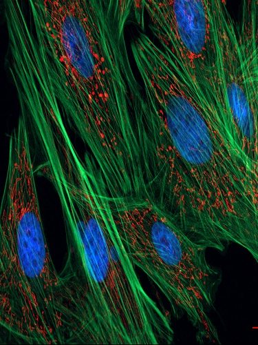 Fibroblast Fibroblast