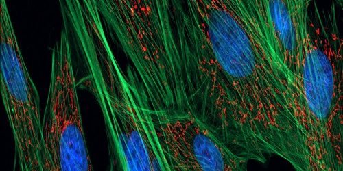Fibroblast Fibroblast