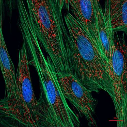 Fibroblast