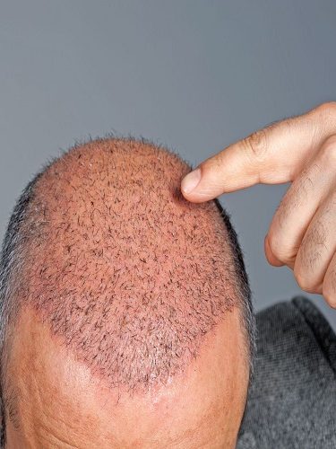 Multi-Implanter Multi-Implanter