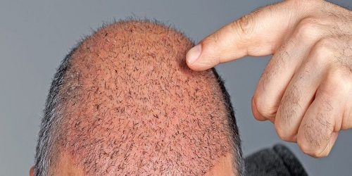 Multi-Implanter Multi-Implanter