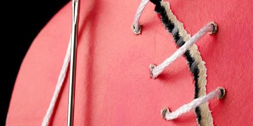 Hymenoplasti Kızlık Zarı