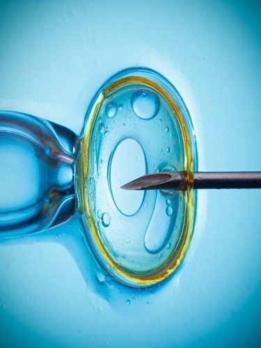 IVF İn Vitro Fertilizasyon IVF İn Vitro Fertilizasyon