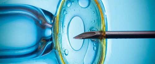 IVF İn Vitro Fertilizasyon