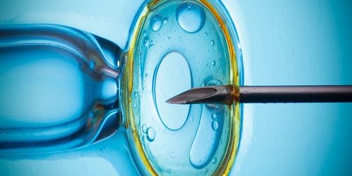 IVF İn Vitro Fertilizasyon