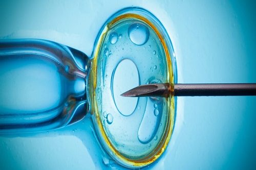 IVF İn Vitro Fertilizasyon
