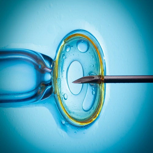 IVF İn Vitro Fertilizasyon