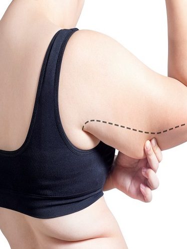 Kol Germe Ameliyatı Kol Germe Ameliyatı