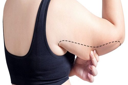 Kol Germe Ameliyatı