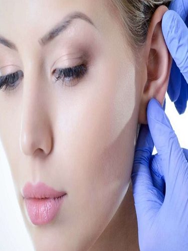 Kulak Estetiği Kulak Estetiği