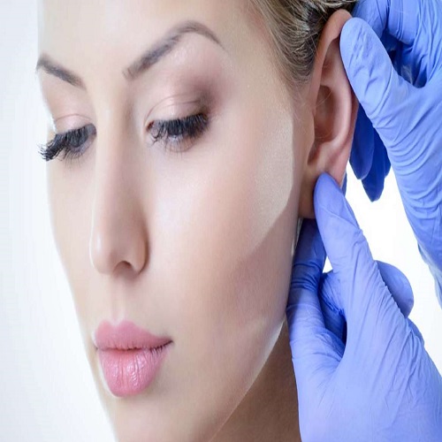 Kulak Estetiği Kulak Estetiği