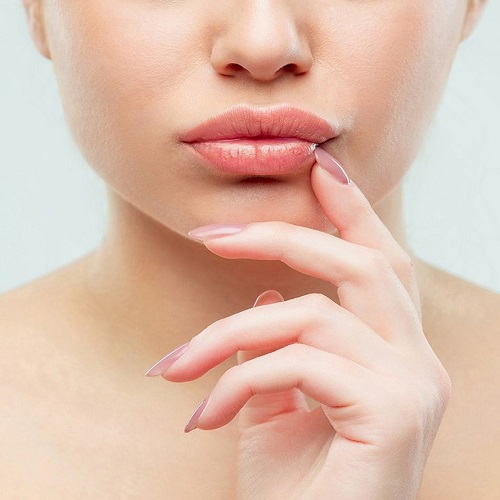 Lip Lift Dudak Estetiği Lip Lift Dudak Estetiği