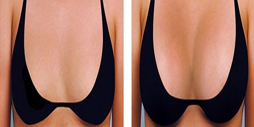 Meme Büyütme Meme Büyütme