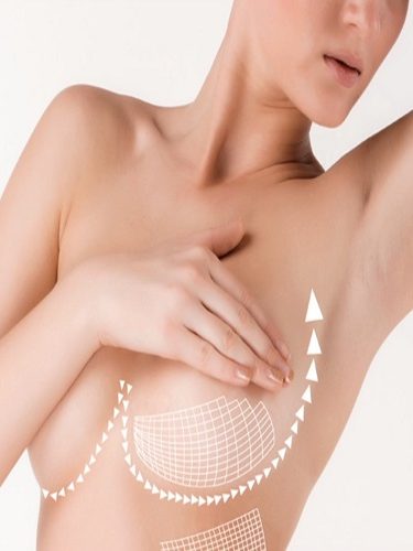 Meme Göğüs Estetiği Meme Göğüs Estetiği