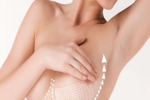 Meme Göğüs Estetiği