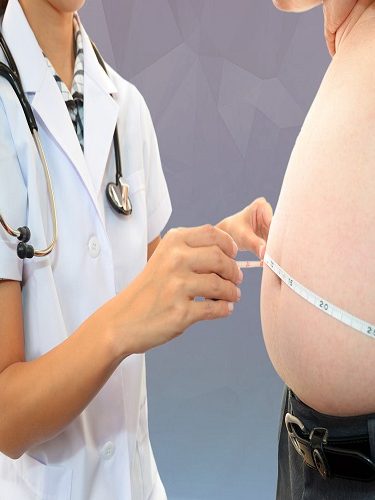 Obezite Cerrahisi Obezite Cerrahisi