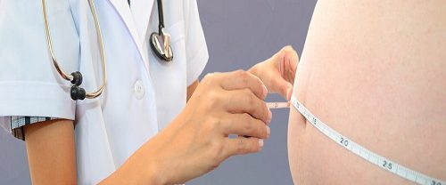 Obezite Cerrahisi