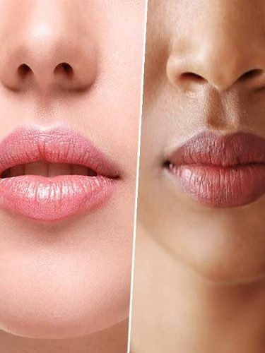 Permalip Dudak Silikonu Permalip Dudak Silikonu