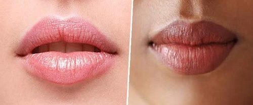 Permalip Dudak Silikonu