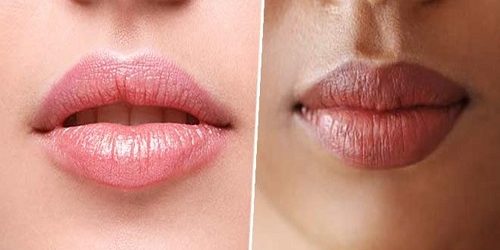 Permalip Dudak Silikonu Permalip Dudak Silikonu