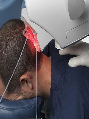 Robotik Saç Ekimi Robotik Saç Ekimi