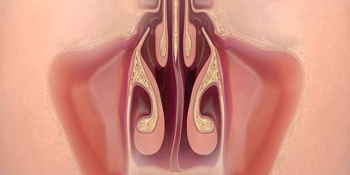 Septoplasti Ameliyatı