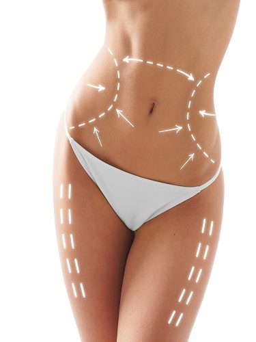 Slim Lipo Lazer Lipoliz Plus Slim Lipo Lazer Lipoliz Plus