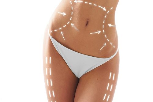 Slim Lipo Lazer Lipoliz Plus