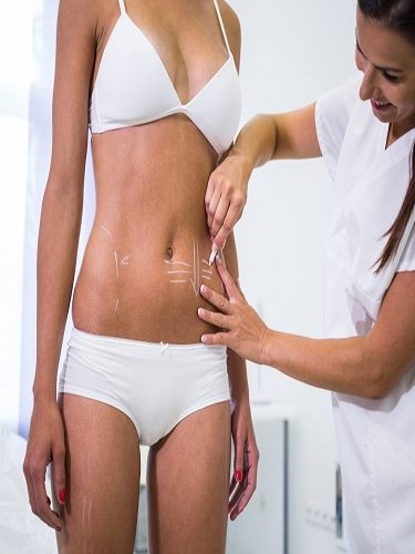 Yağ Aldırma Yağ Aldırma