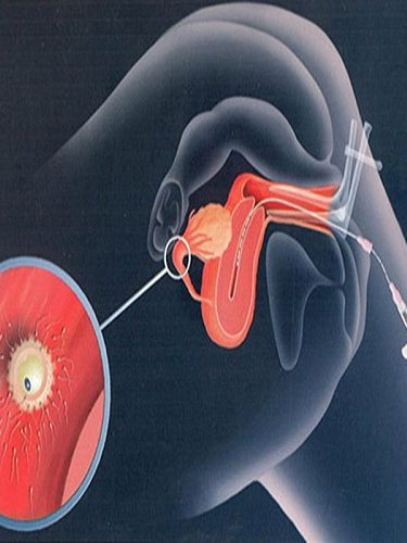 Yapay İnseminasyon Aşılama Yapay İnseminasyon Aşılama